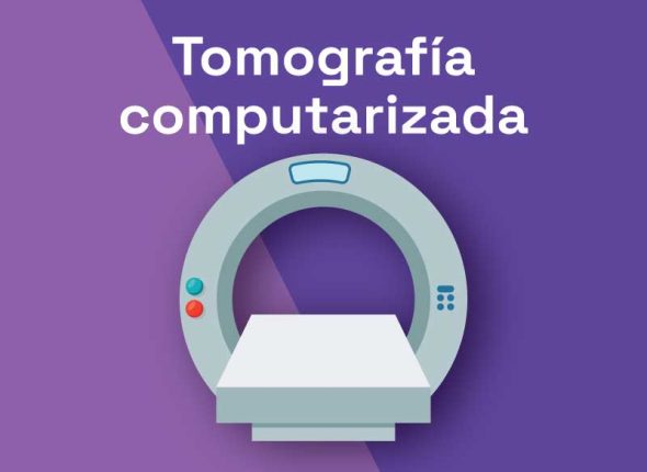 tomografía computerizada