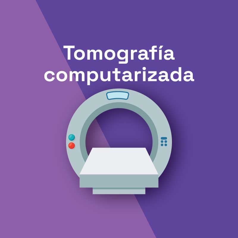 tomografía computerizada