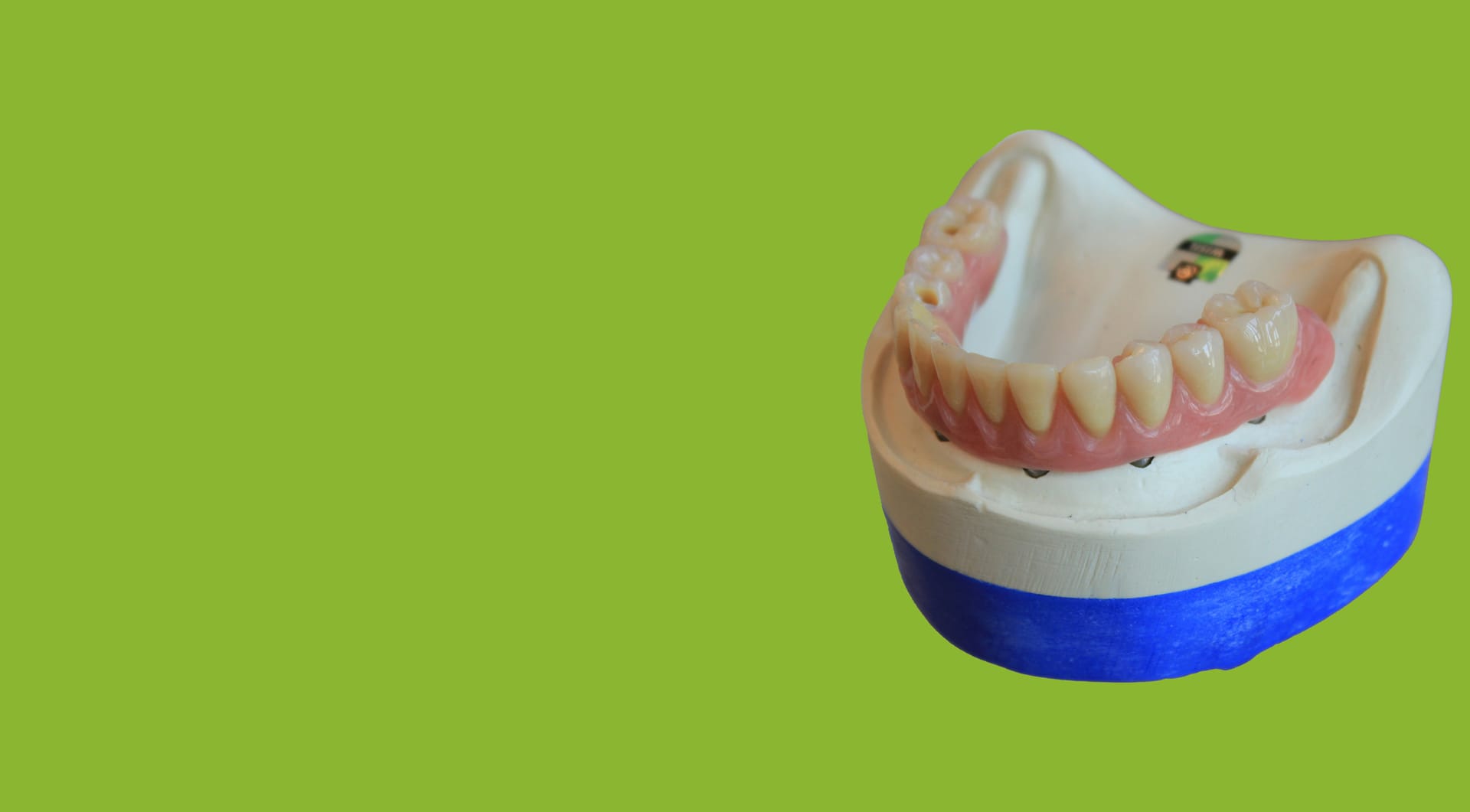 Técnico Superior en Prótesis Dentales