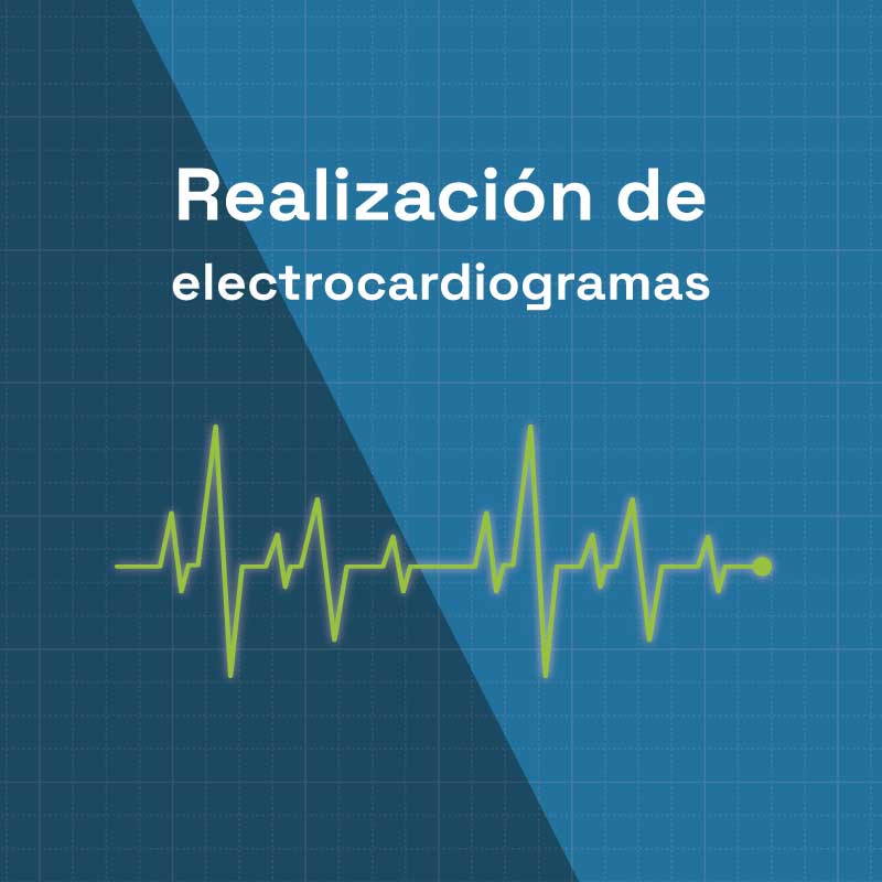 Realización de electrocardiogramas