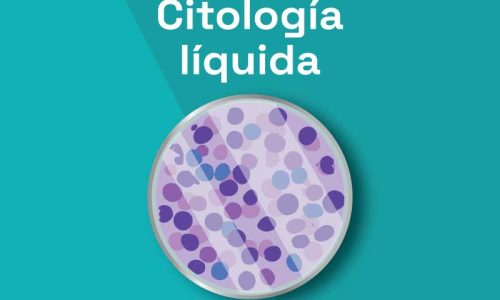 miniatura del curso