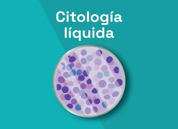 Teleformación - Citología Líquida