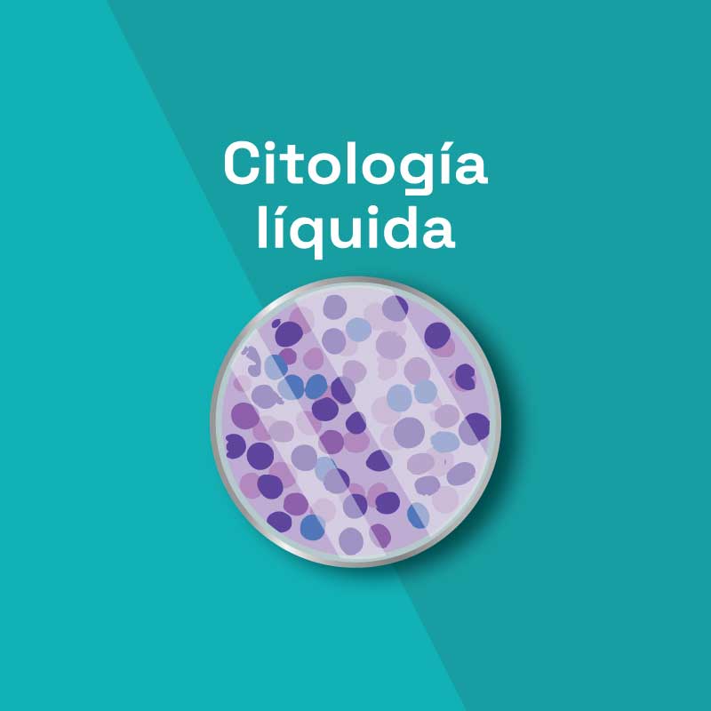 Teleformación - Citología Líquida