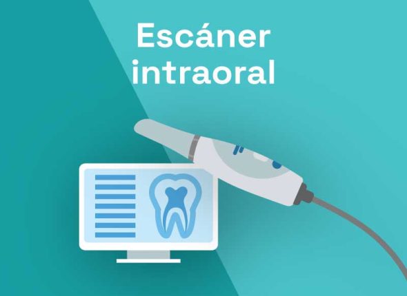 Escaner Intraoral