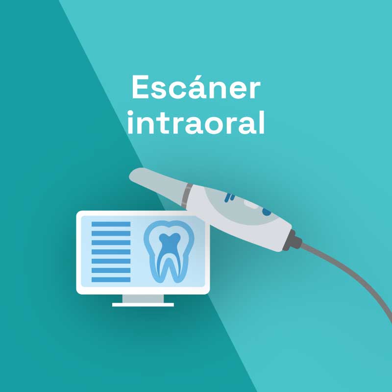Escaner Intraoral
