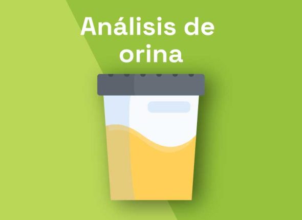 Analisis de orina