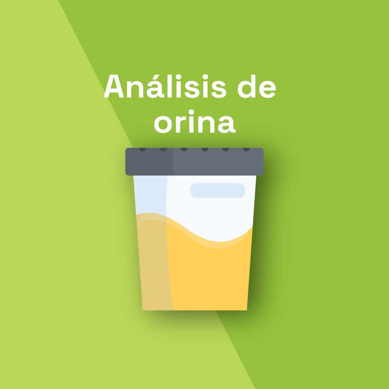 Analisis de orina